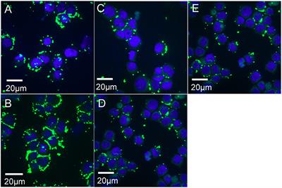 Global Transcription Profiles of Anaplasma phagocytophilum at Key Stages of Infection in Tick and Human Cell Lines and Granulocytes